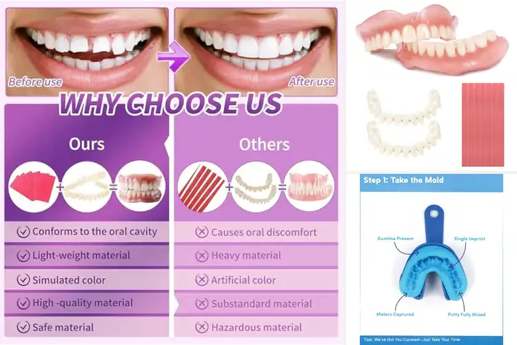 Detailed view of Best Denture Diy Kit For A Brighter Smile