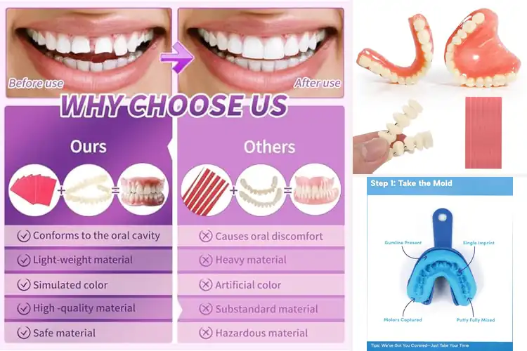 Detailed view of Best Denture DIY Kits For Full Smile Restoration