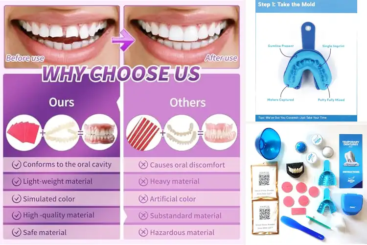 Detailed view of Best Diy Denture Kit For Home Use: Craft Your Perfect Smile