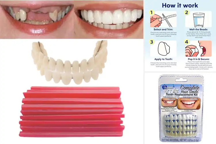 Detailed view of Best Do It Yourself Teeth Kit For Missing Teeth Repair