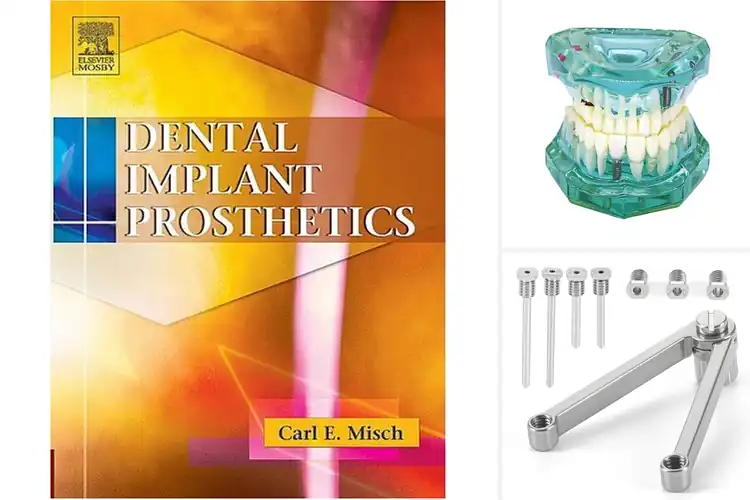 Detailed view of Best Oral Prosthetics: Transform Your Smile & Health Today