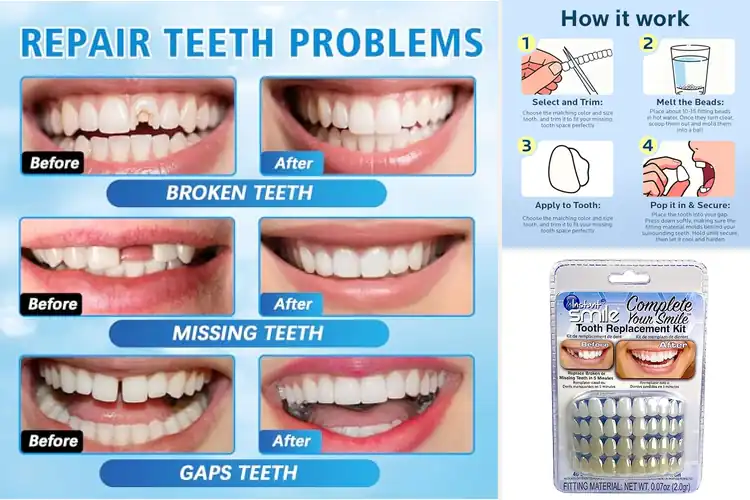Detailed view of Best Teeth Repair and Replacement Kit