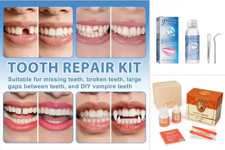 Detailed view of Best Teeth Repair Kit